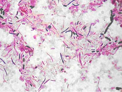 マウス腸内細菌のグラム染色図：青がグラム陽性菌、ピンクがグラム陰性菌。丸い形の菌を球菌といい、細長いものを桿菌と呼ぶ